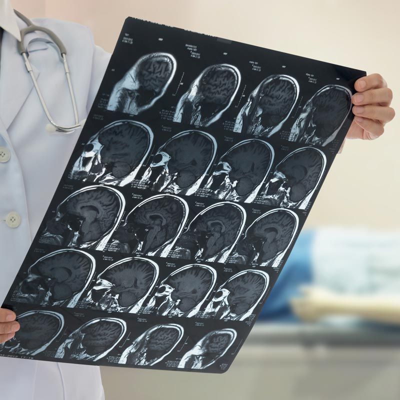 Doctor looking at sheet of MRIs